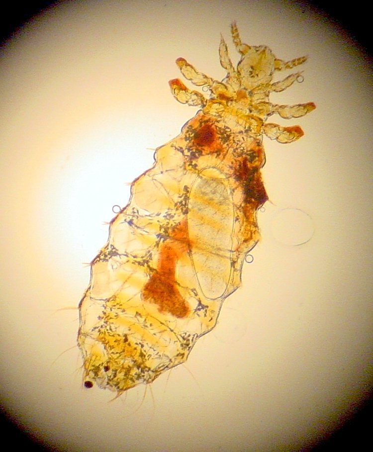Dog lice under microscope - Can humans get dog lice?