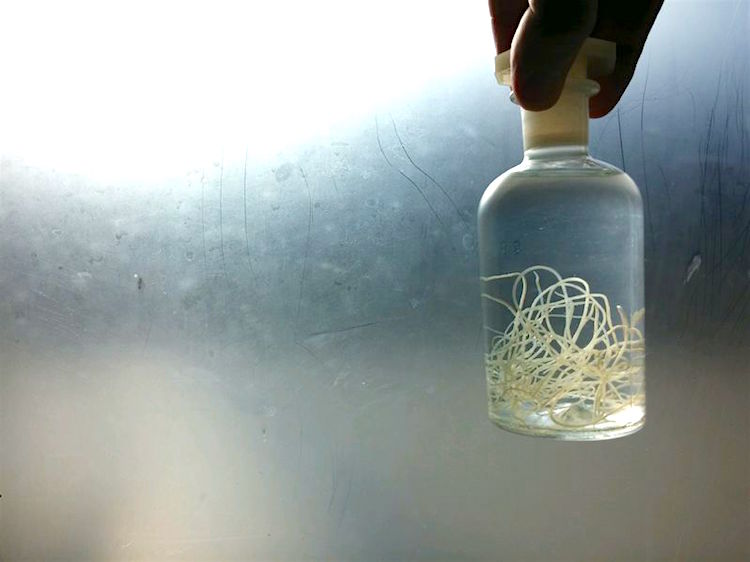 Bottle with heartworm, extracted during surgery. By: mvatrabu